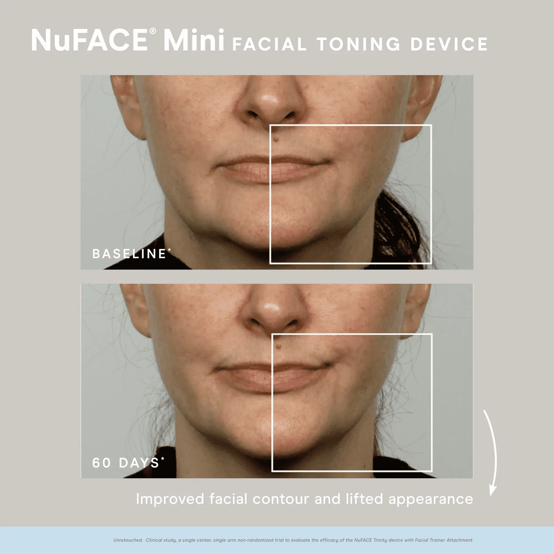 Photo 3 - NuFACE mini Facial Toning Device (includesl Gel Primer)